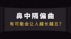 鼻中隔偏曲有什么检查方法