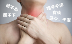 重庆哪家医院治疗慢性咽炎好，慢性咽炎的症状及治疗