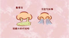 重庆仁品耳鼻喉医院_鼻窦炎的预防方法有哪些