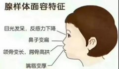 重庆耳鼻喉科医院排名_腺样体肥大的预防方法