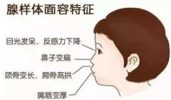 重庆耳鼻喉专科_腺样体肥大的预防方法