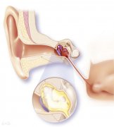 重庆耳鼻喉科医院排名_中耳炎是如何引起的