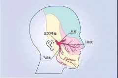 有一种特殊的头痛，竟是鼻子惹的祸？