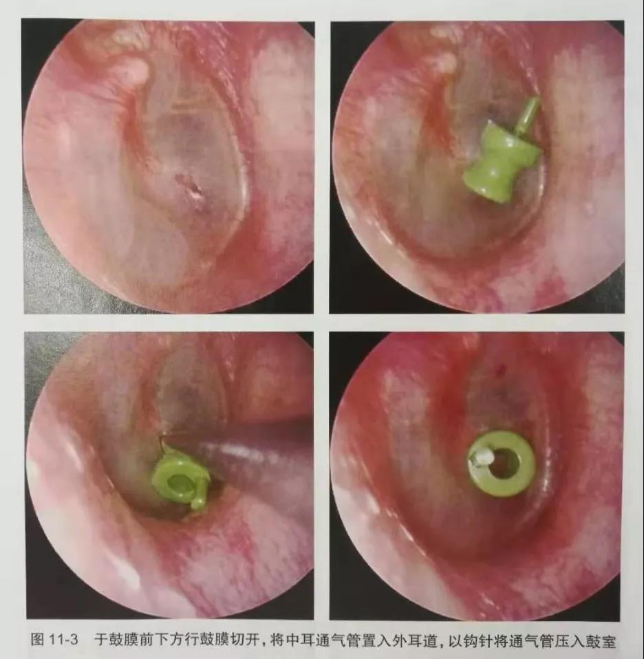 重庆耳鼻喉科医院排名