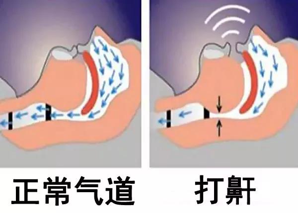 重庆耳鼻喉科医院排名