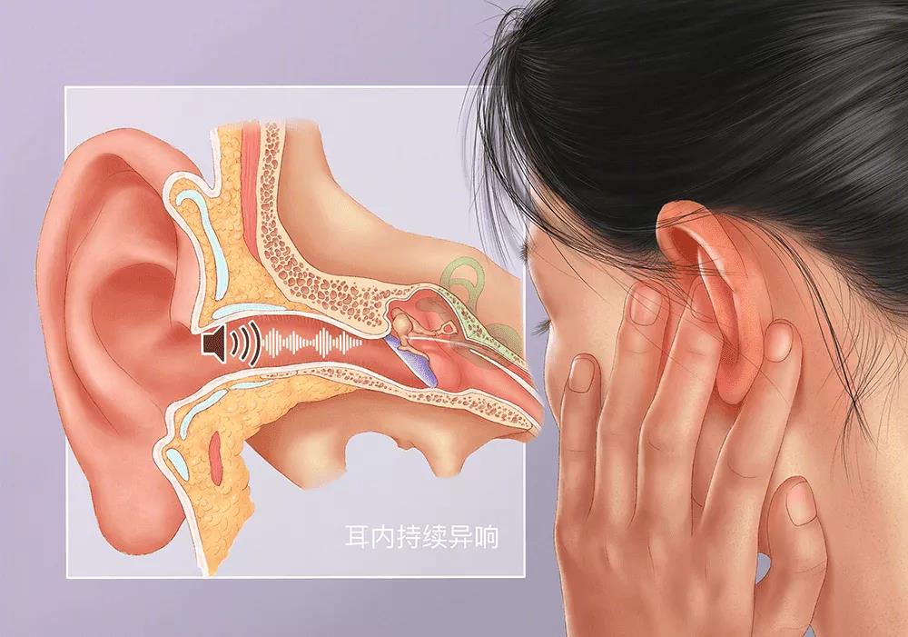 耳鸣的治疗方法