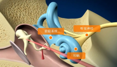 头晕、头昏还是眩晕？头晕头昏眩晕三者的区别