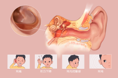 重庆治疗中耳炎医院，中耳炎的治疗方法
