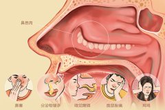 重庆耳鼻喉科医院排名，鼻息肉病的临床症状