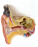 人工耳蜗植入手术“拯救”您的听力健康